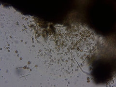 Chaenotheca hispidula