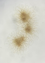 Trichodesmium
