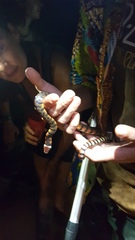 Hydrops triangularis