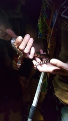 Hydrops triangularis