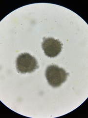 Sphaerocarpos michelii