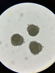 Sphaerocarpos michelii