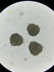 Sphaerocarpos michelii