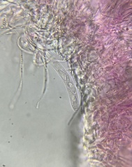 Arachnopeziza trabinelloides