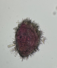Arachnopeziza trabinelloides