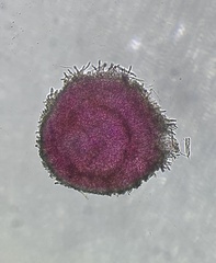 Arachnopeziza trabinelloides
