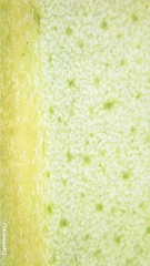 Tristaniopsis laurina