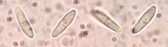Arachnopeziza trabinelloides
