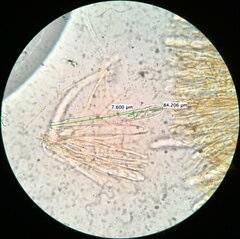 Arachnopeziza trabinelloides