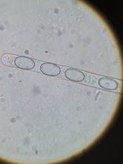 Pseudaleuria fibrillosa