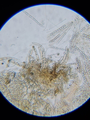 Pseudaleuria fibrillosa