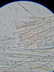 Pseudaleuria fibrillosa