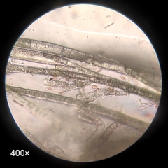 Acrochaetiaceae