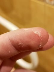 Staphylococcus aureus