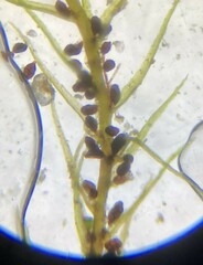 Leptobryum pyriforme