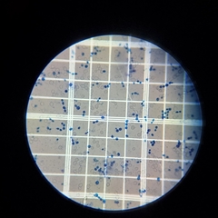 Saccharomyces cerevisiae