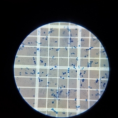 Saccharomyces cerevisiae