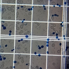 Saccharomyces cerevisiae