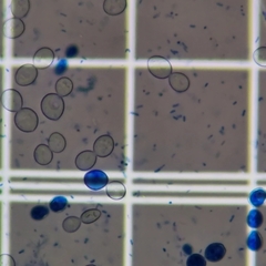 Saccharomyces cerevisiae