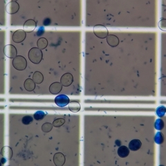 Saccharomyces cerevisiae