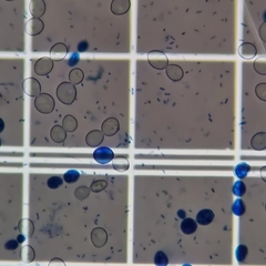 Saccharomyces cerevisiae