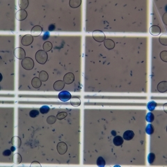Saccharomyces cerevisiae