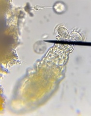 Rotifera