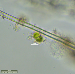 Desmococcus