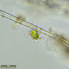 Desmococcus