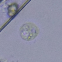 Protozoa