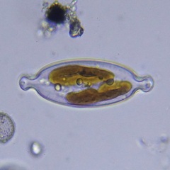 Caloneis amphisbaena