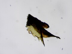 Frullania selwyniana