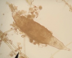 Rotaria tardigrada
