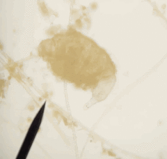 Rotaria tardigrada