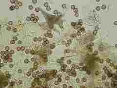 Physarum alexandrowiczii