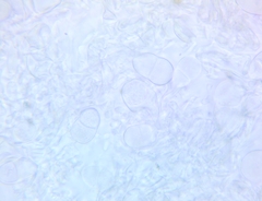 Trichothecium roseum