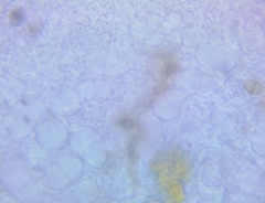 Trichothecium roseum