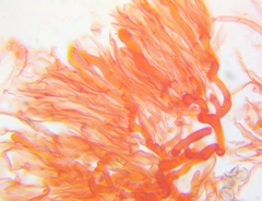 Dacrymyces minor