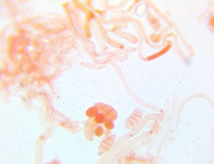Dacrymyces minor