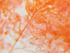 Dacrymyces minor