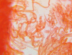 Dacrymyces minor