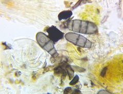 Bactrodesmium leptopus