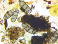 Bactrodesmium leptopus