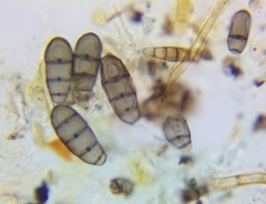 Bactrodesmium leptopus