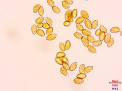 Phlegmacium balteatocumatile