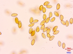 Phlegmacium balteatocumatile