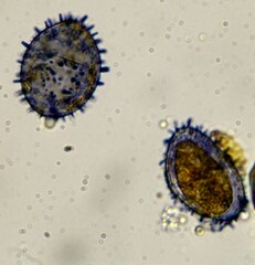 Aleurodiscus wakefieldiae