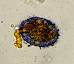 Aleurodiscus wakefieldiae