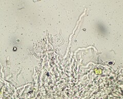 Aleurodiscus wakefieldiae