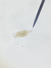 Bdelloidea
